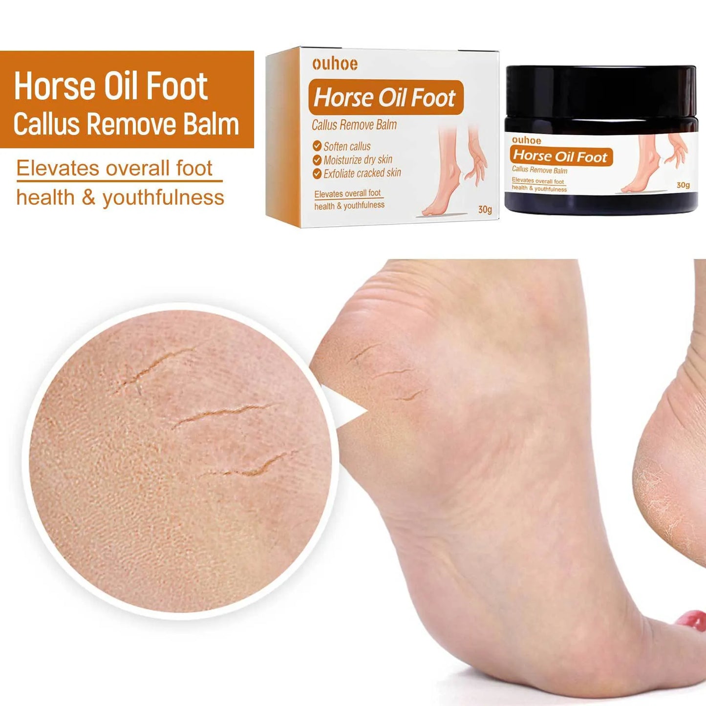 Horse Oil Foot Callus Remove Balm