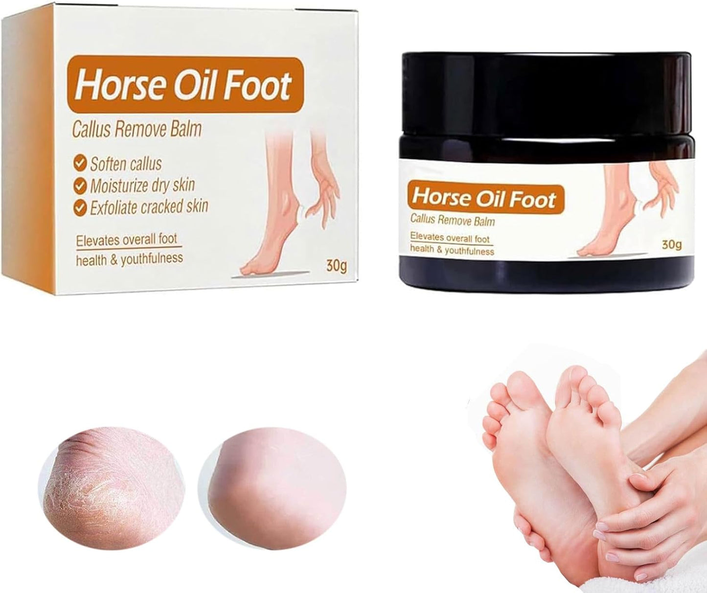 Horse Oil Foot Callus Remove Balm