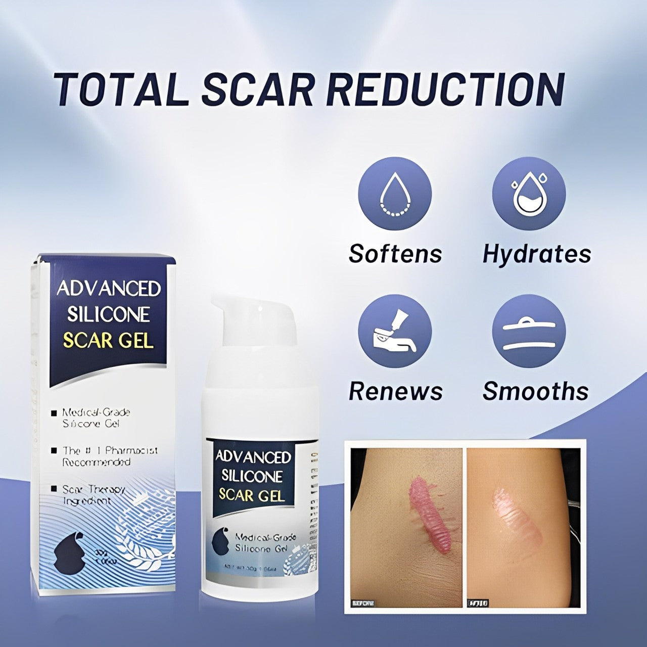 Scar Removal Gel 2