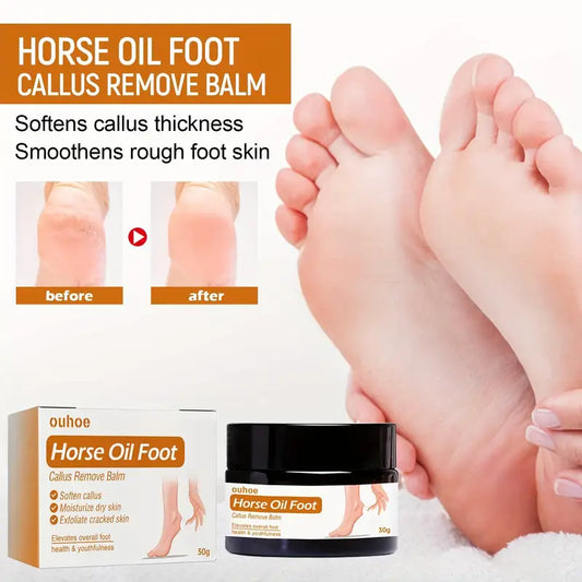 ORIGINAL Horse Oil Foot Callus Remedy Balm