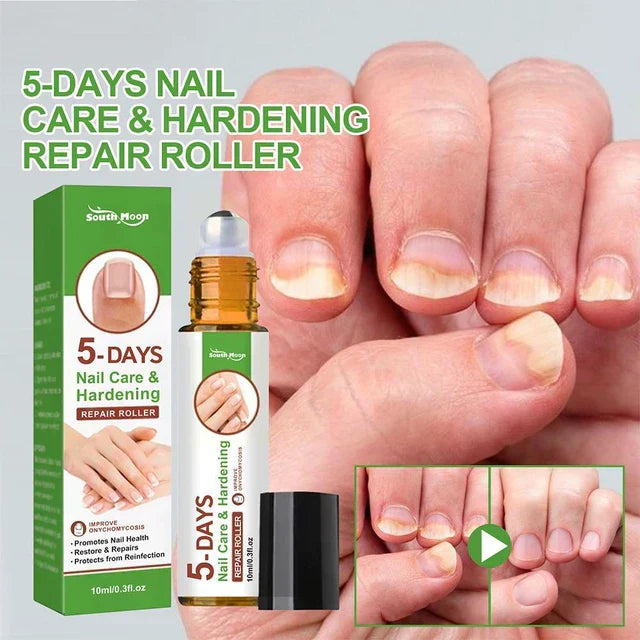 Transform Your Nails in Just 5 Days Now